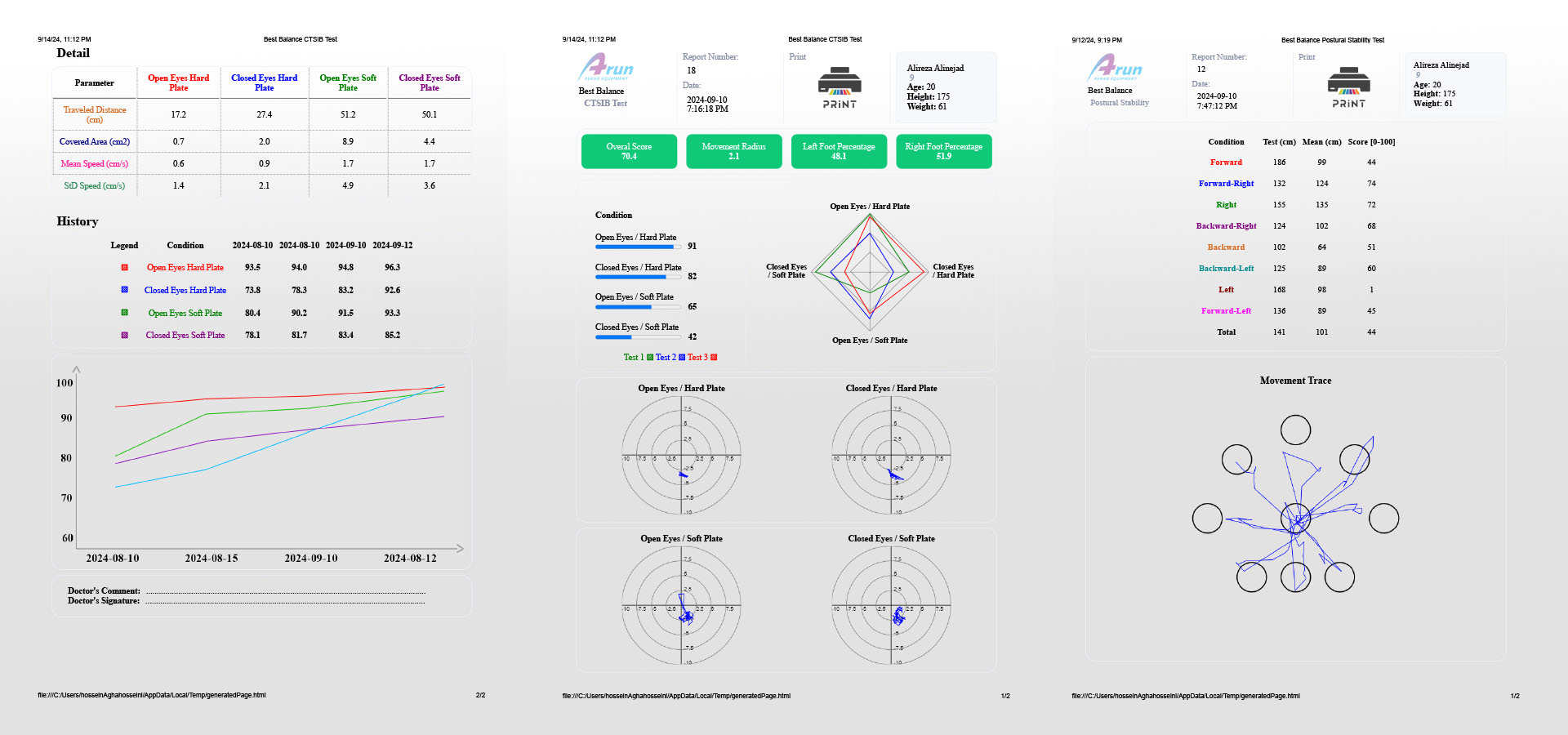 Best Balance Bio Force plate test results